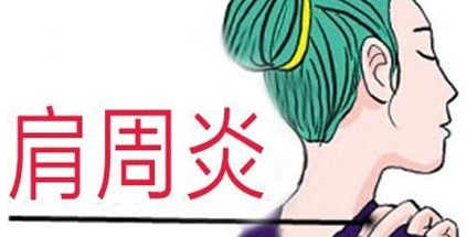 不良習慣為肩周炎埋下伏筆？玄鹿中頻治療儀