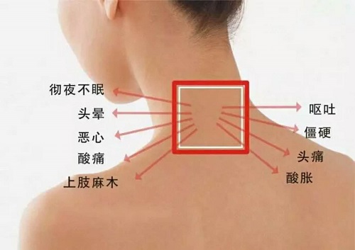 你的頸椎還健康嗎？