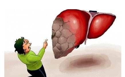 頭部出現(xiàn)這4種狀況，就要注意你的肝了！